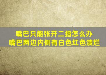 嘴巴只能张开二指怎么办 嘴巴两边内侧有白色红色溃烂